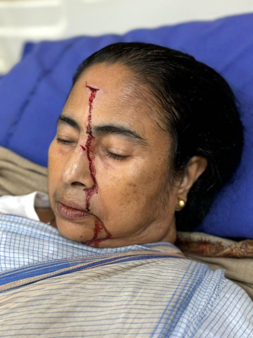 West Bengal CM Mamata Banerjee suffers major injury in accident, hospitalised: TMC