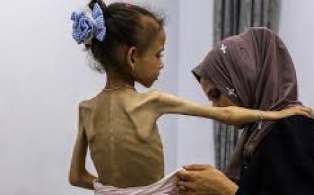 UN declares famine in Gaza; 2 people starve to death in 24 hours
