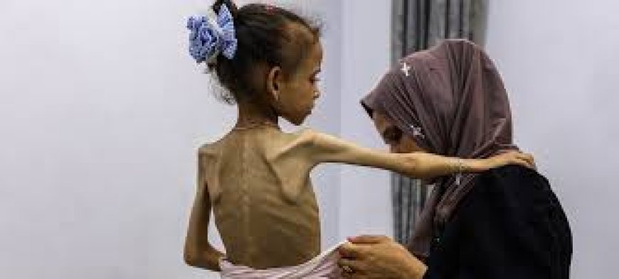 UN declares famine in Gaza; 2 people starve to death in 24 hours