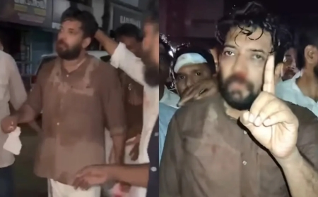 പോലീസ് അതിക്രമം: പരിക്കേറ്റ  ഷാഫിയുടെ മൂക്കിന്റെ 2 എല്ലുകൾക്ക് പൊട്ടൽ