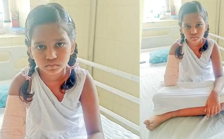 Waiting for ‘new arm’, Kerala's 9-year-old Vinodini holding on to her dream