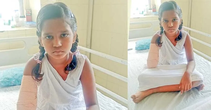 Waiting for ‘new arm’, Kerala's 9-year-old Vinodini holding on to her dream