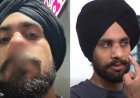 Indian-origin nurse attacked, called ‘Indian dog’ by three men in Australia's Geelong