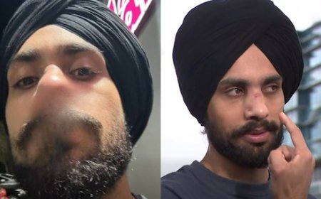 Indian-origin nurse attacked, called ‘Indian dog’ by three men in Australia's Geelong