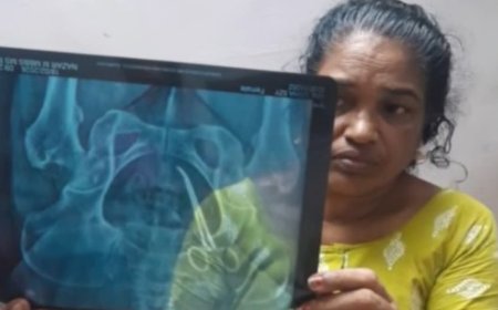 അഞ്ചു വര്‍ഷം മുന്‍പ് ശസ്ത്രക്രിയയ്ക്കിടെ വീട്ടമ്മയുടെ വയറ്റില്‍   കത്രിക  മറന്നുവെച്ചു; ആലപ്പുഴ  വണ്ടാനം മെഡിക്കൽ കോളജിനെതിരെ ഗുരുതര പരാതി