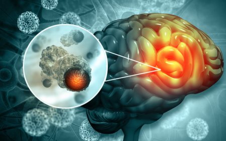 The tell-tale sign of brain cancer doctors say you shouldn't ignore