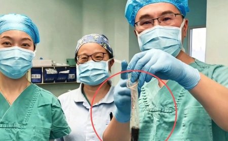 Surgery reveals 20-year-old secret inside man's body