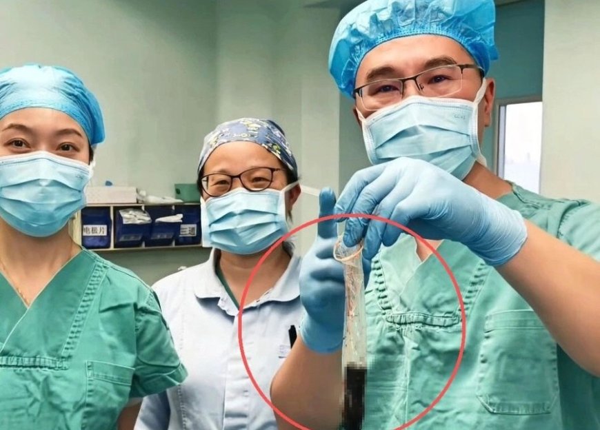 Surgery reveals 20-year-old secret inside man's body