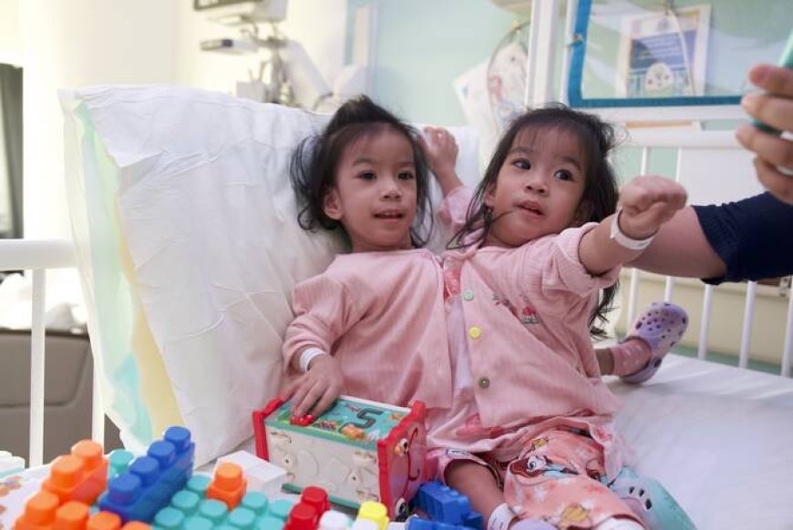 Conjoined twins separated following six-hour surgery in Saudi Arabia