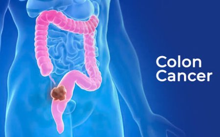 Doctors say this 'embarrassing' symptom could be a warning sign of colorectal cancer